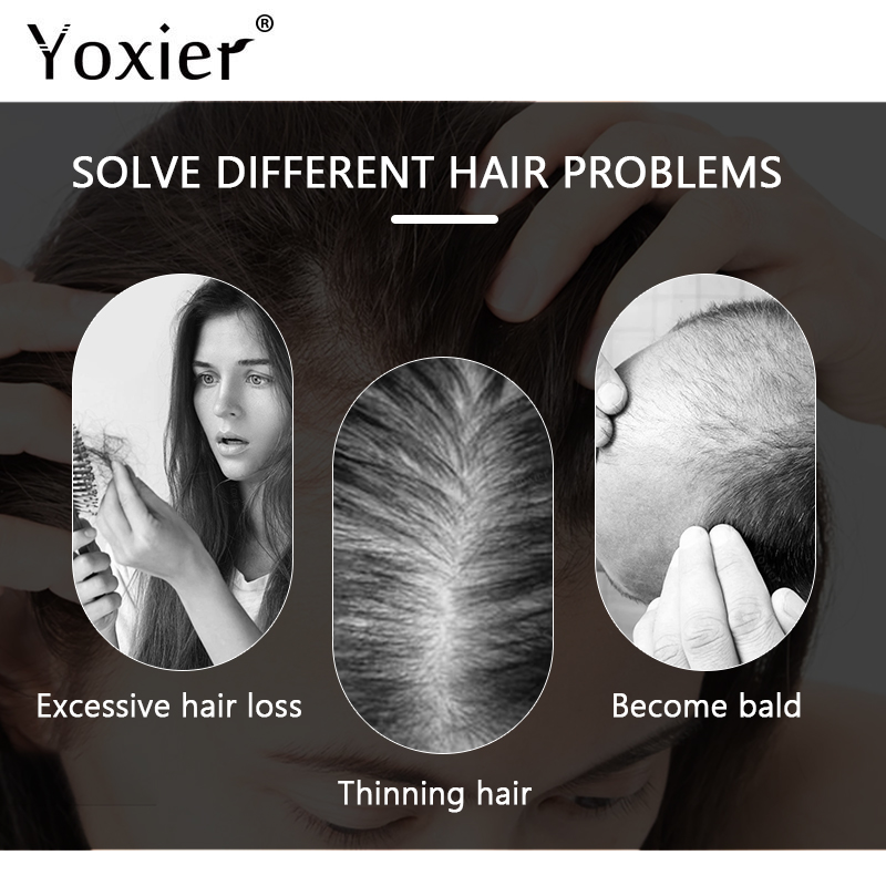 Intensive Growth Serum Prevent - Hair Care Hair Serum review and price