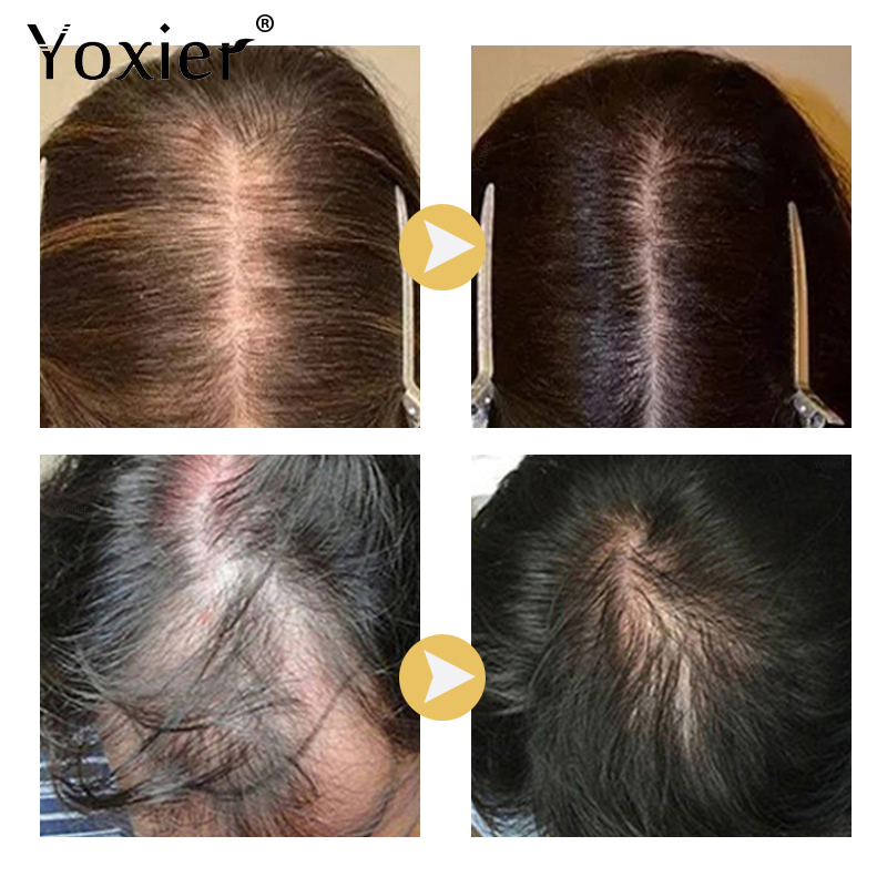 Intensive Growth Serum Prevent - Hair Care Hair Serum review and price