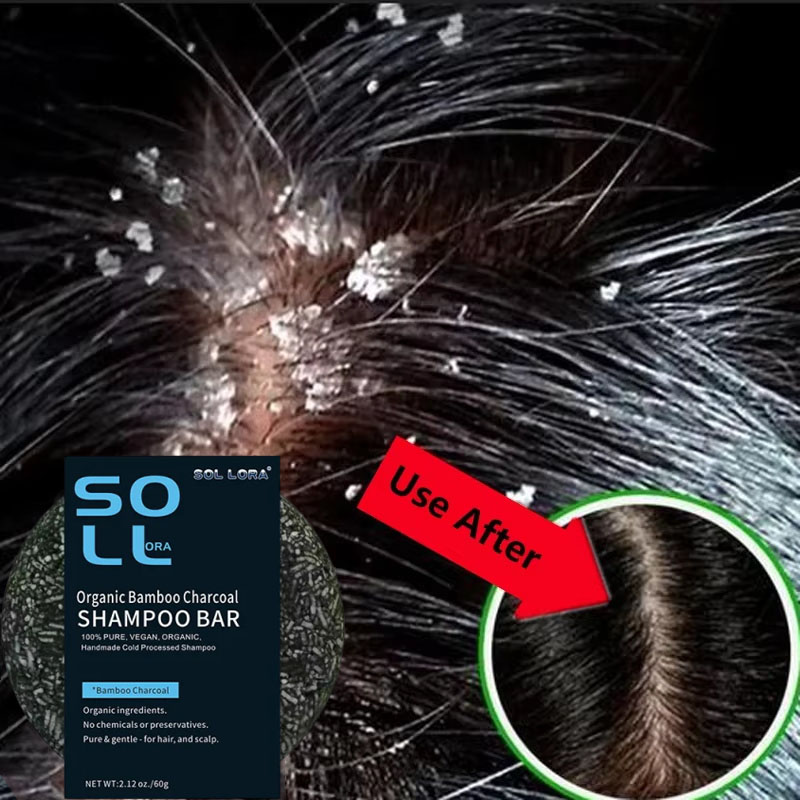 Fast Anti Dandruff Hair Treatm - Hair Care Dandruff review and price