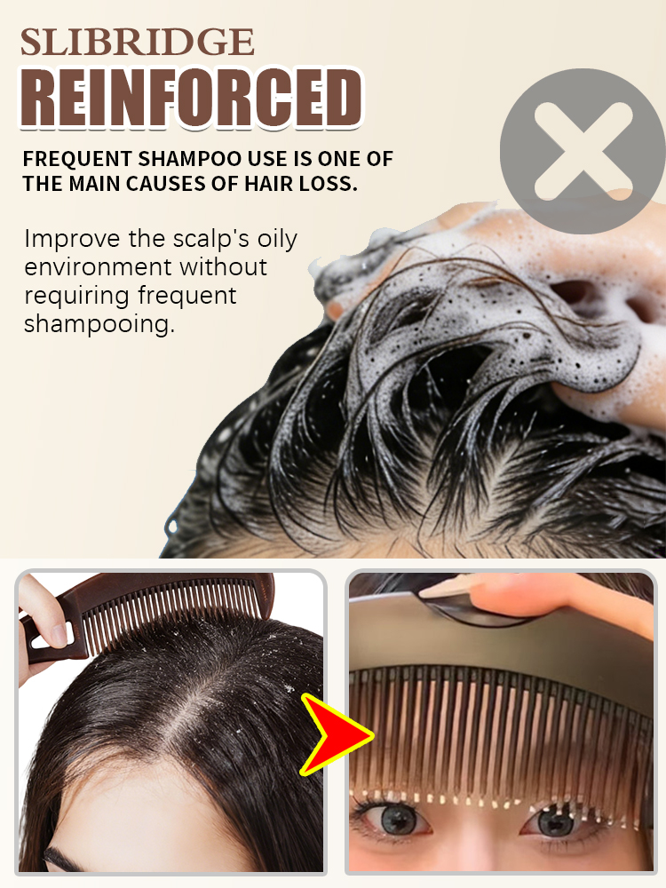 Scalp Oil Removal Comb Dandruf - Hair Care Dandruff review and price