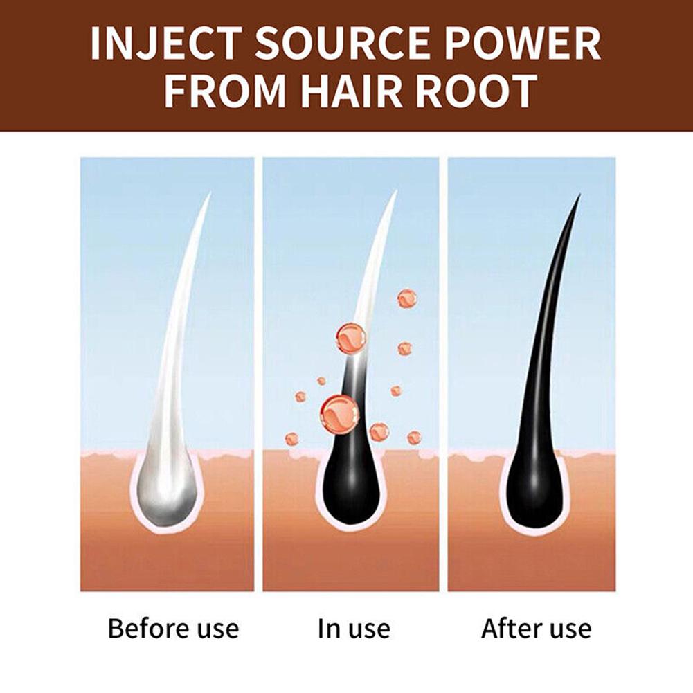 Natural Polygonum Handmade Soa - Hair Care Dandruff review and price